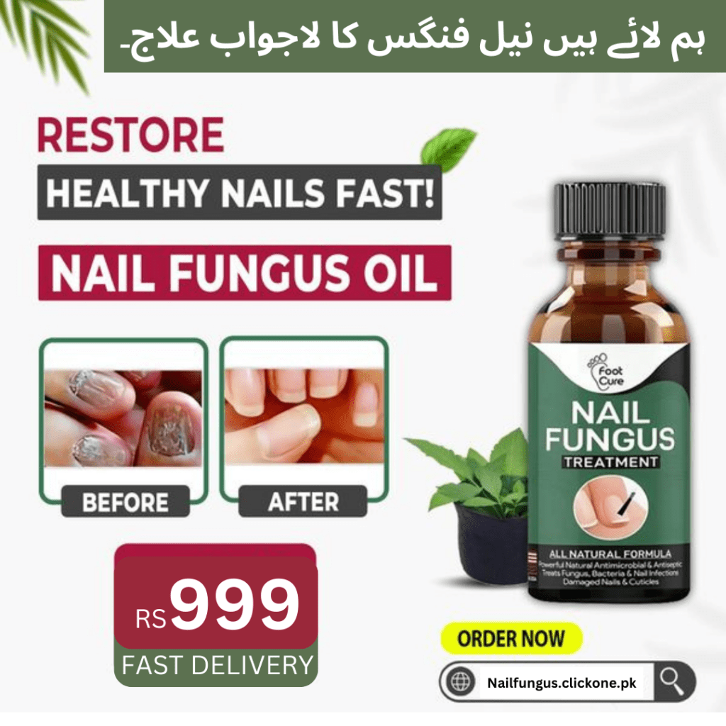 Nail Fungus Image